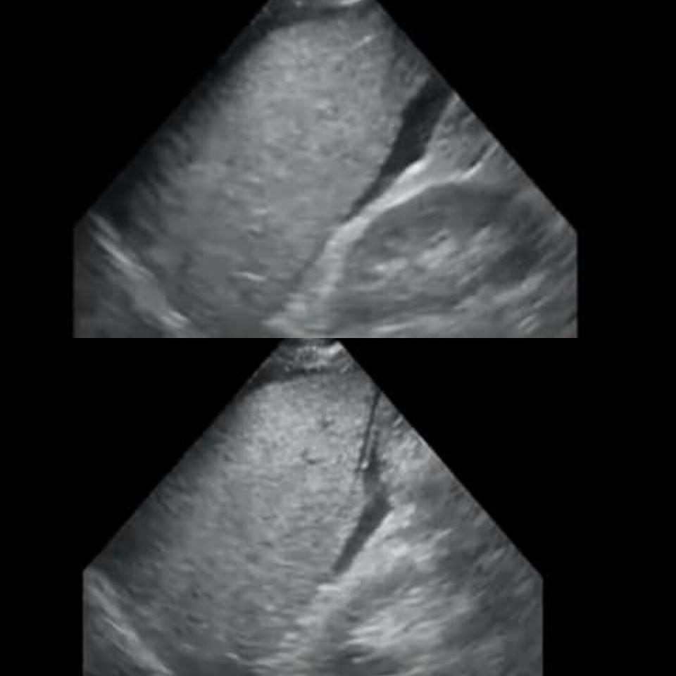 ultrasound.jpg