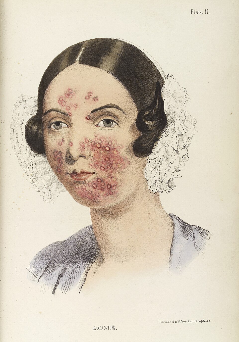 acnewoman'sface.jpg